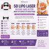 5D Lipo Laser Before and After: What to Expect at Each Stage