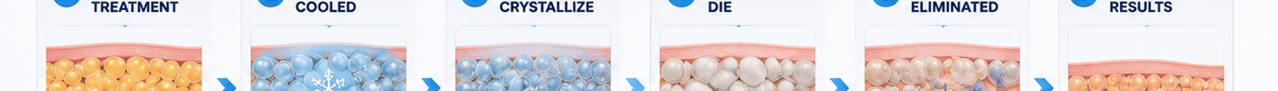 What Happens to Fat Cells After Cryolipolysis? The Science Explained Simply