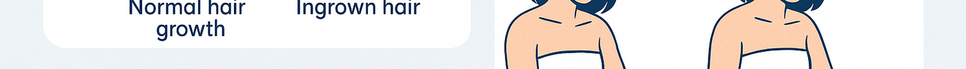 What is Ingrown Hair & How to Remove Ingrown Hair