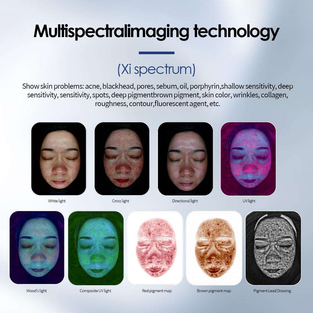 AI skin analysis department report