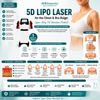 5D Lipo Laser for the Chest and Bra Bulge: Upper Body Fat Reduction Protocol