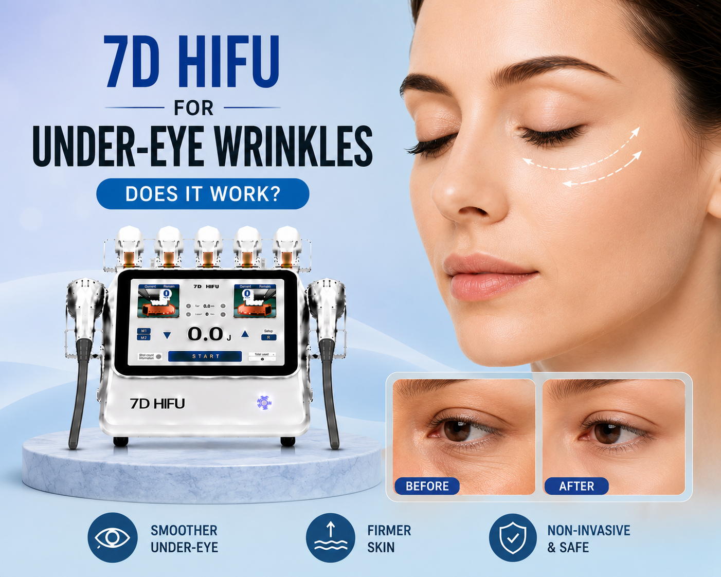 7D HIFU for Under-Eye Wrinkles: Does It Work?