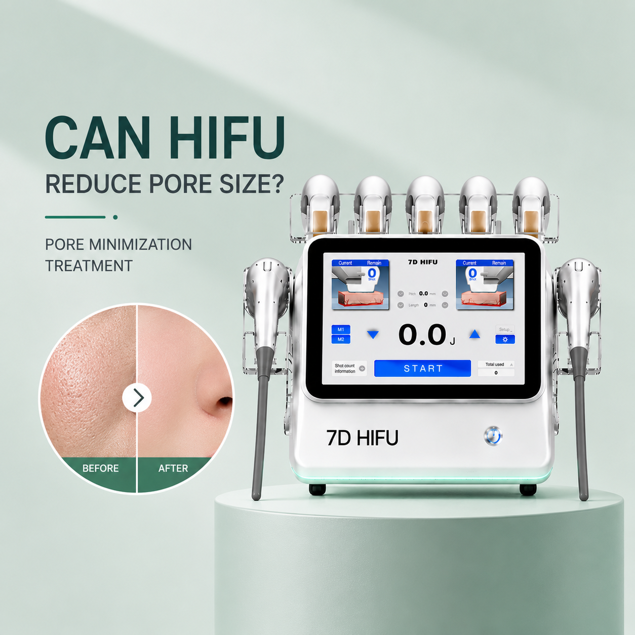 Can HIFU Reduce Pore Size? Pore Minimization Treatment Explained