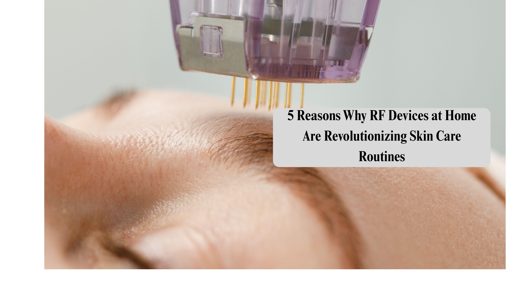 Discover the Top Benefits of Using a Radio Frequency Microneedling Machine for Youthful Skin