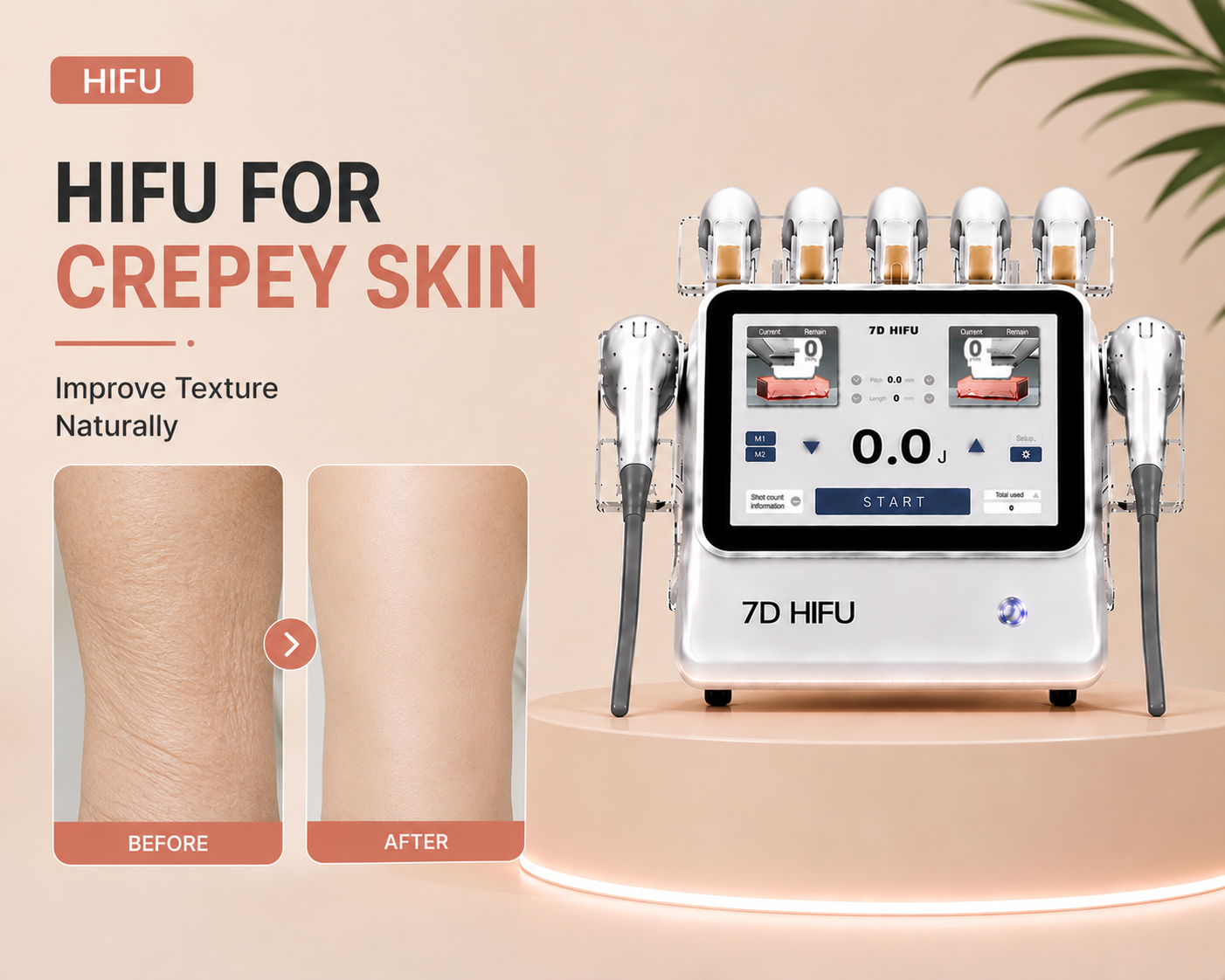 HIFU for Crepey Skin: Improve Texture and Skin Quality Naturally