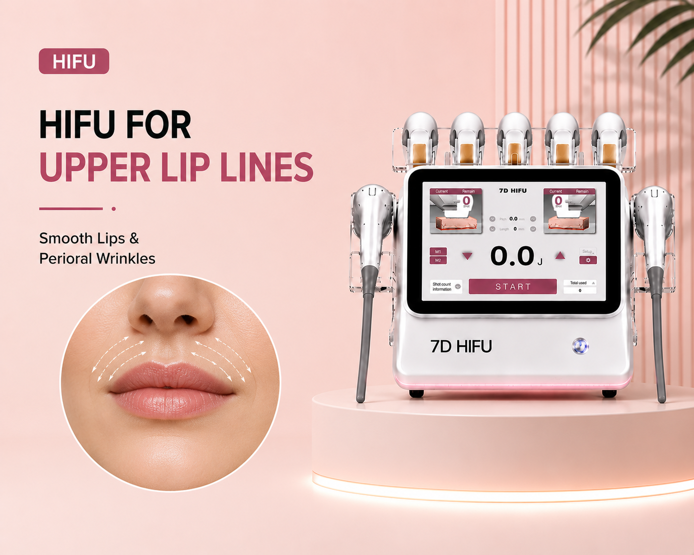 HIFU for Upper Lip Lines: Smooth Lips and Perioral Wrinkles