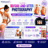 Cryolipolysis Machine vs. Cavitation Machine: Which Should Your Clinic Buy First?