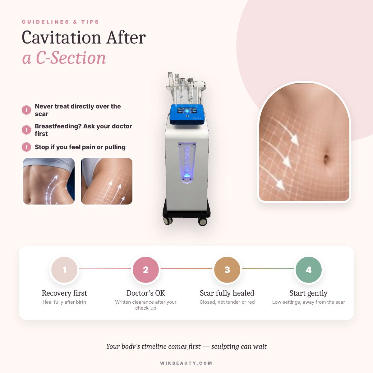 Safe Cavitation Post-C-Section: Guidelines & Tips