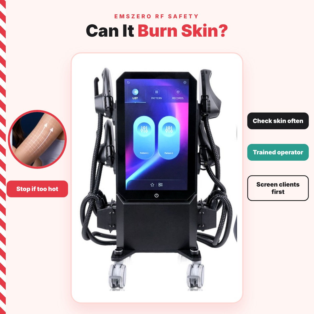 Can EMSzero Burn Skin? Understanding RF Safety