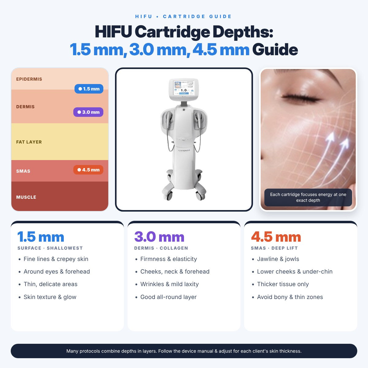 HIFU Cartridge Depths: 1.5mm, 3.0mm, 4.5mm Guide