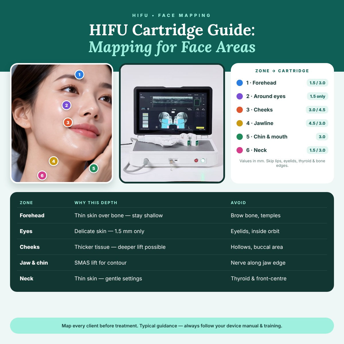 HIFU Cartridge Guide: Mapping for Face Areas