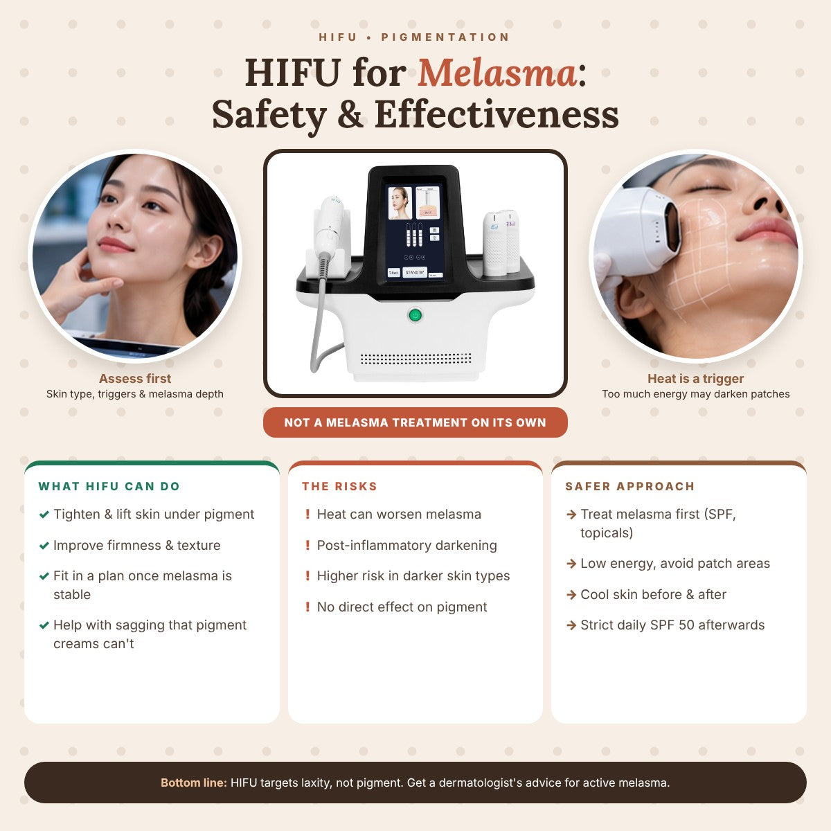 HIFU for Melasma: Safety and Effectiveness