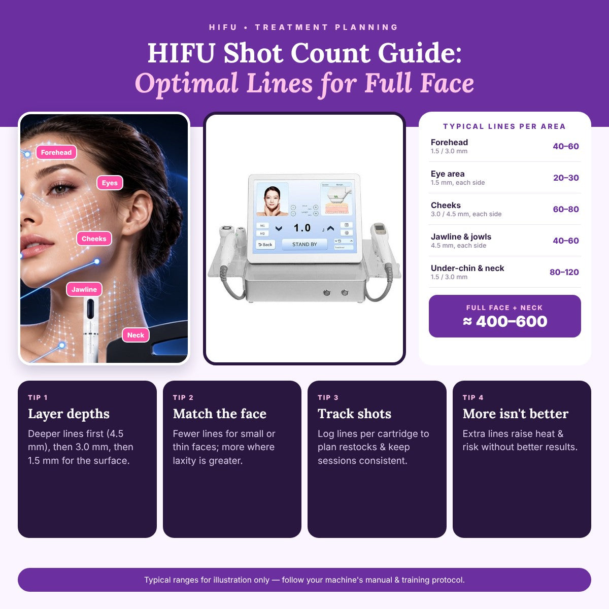 HIFU Shot Count Guide: Optimal Lines for Full Face