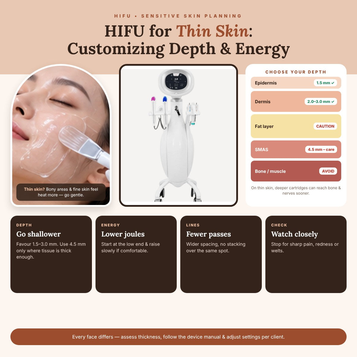 HIFU for Thin Skin: Customizing Depth & Energy