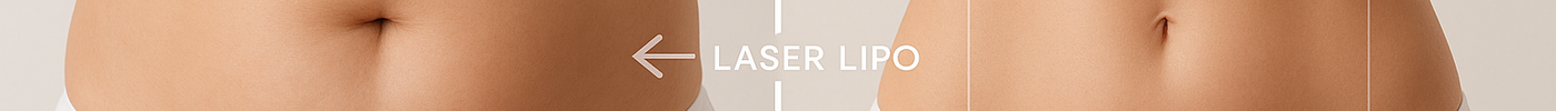Laser Lipo Before and After