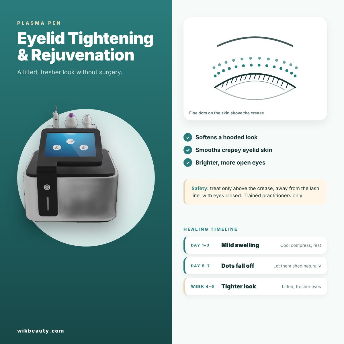 Plasma Pen: Eyelid Tightening & Rejuvenation