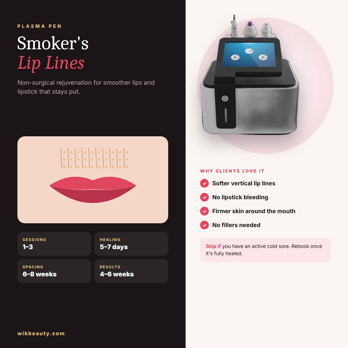 Plasma Pen for Smoker's Lip Lines: Non-Surgical Rejuvenation