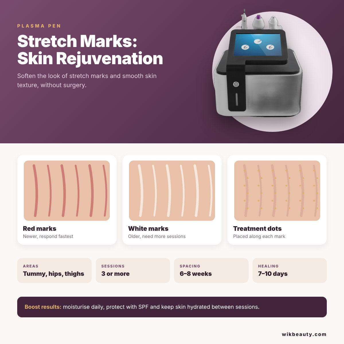 Plasma Pen for Stretch Marks: Non-Surgical Skin Rejuvenation