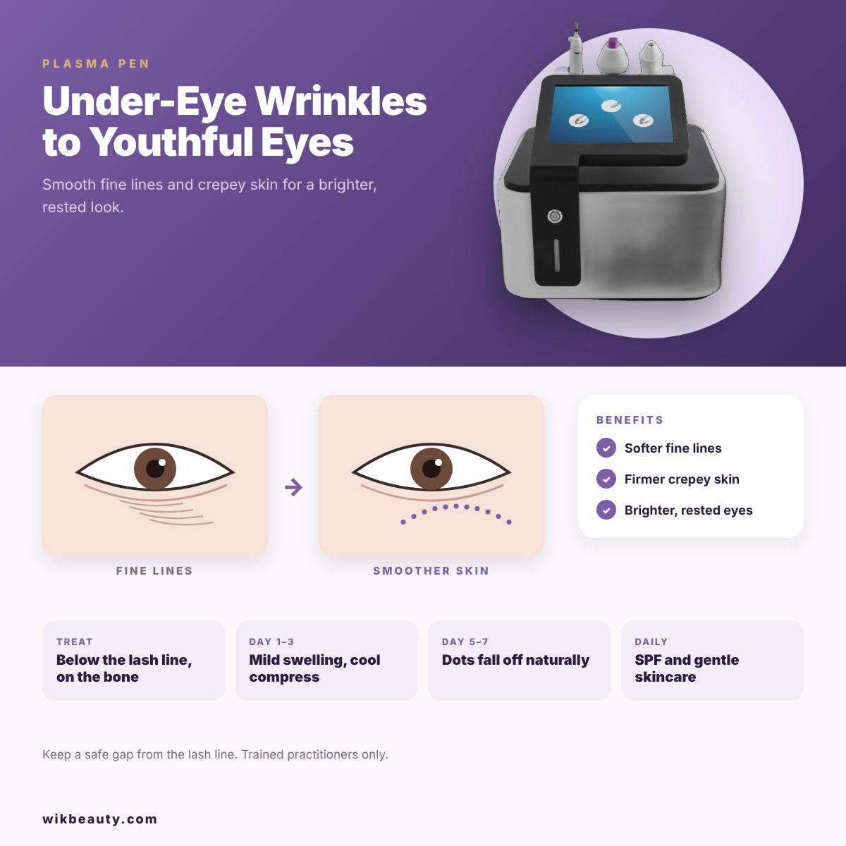 Plasma Pen for Under-Eye Wrinkles: Youthful Eyes