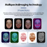 AI skin analysis department report